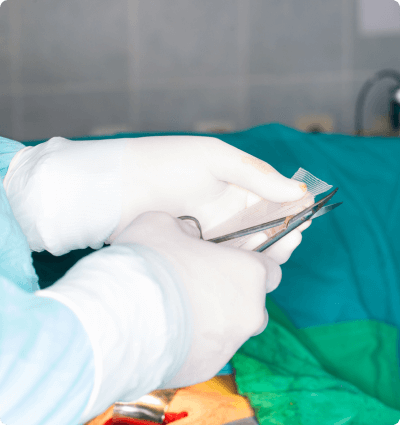 Doctor cutting small piece of mesh for surgery