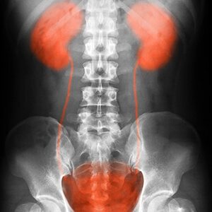 Kidney Injury Affected Area