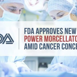 four surgeons operating