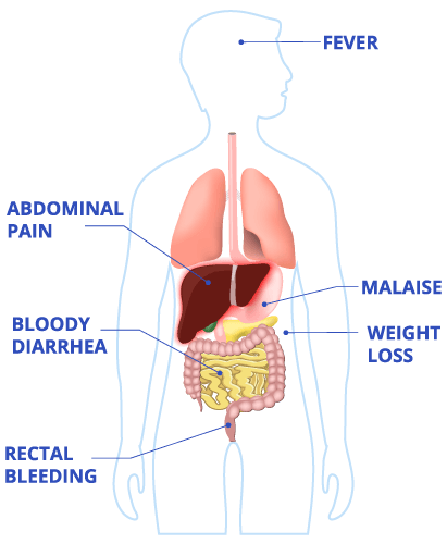 Accutane Weight Chart