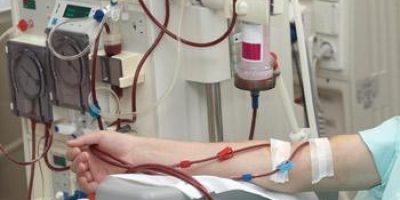 Patient receiving dialysis