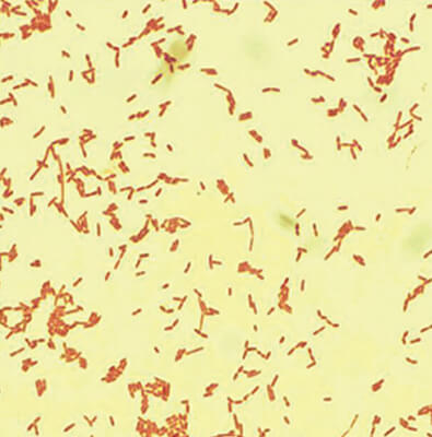 haemophilus-influenzae-type-b Microscopic view of Haemophilus Influenzae Type B