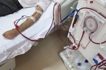 Older Man in Hospital Undergoing Dialysis