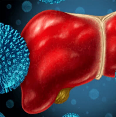 hepatitis Microscopic view of Hepatitis