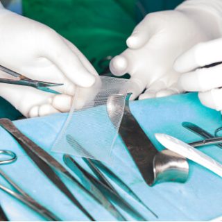 Hernia Mesh Being Handled by Surgeons