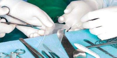 Hernia Mesh Being Handled by Surgeons