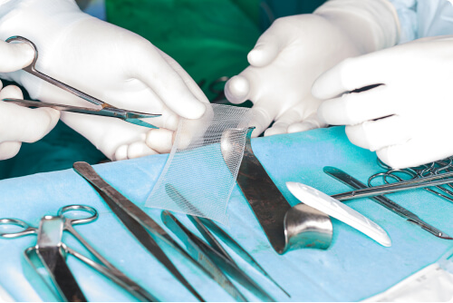 Hernia Mesh Being Handled by Surgeons