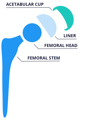 hip replacement components
