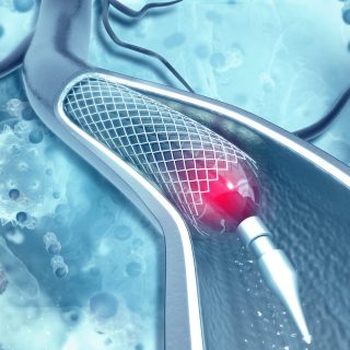 Braint stent