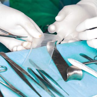 Surgical mesh for hernia repair