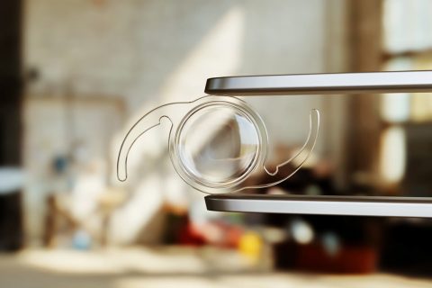 A intraocular lens used for cataract surgery.