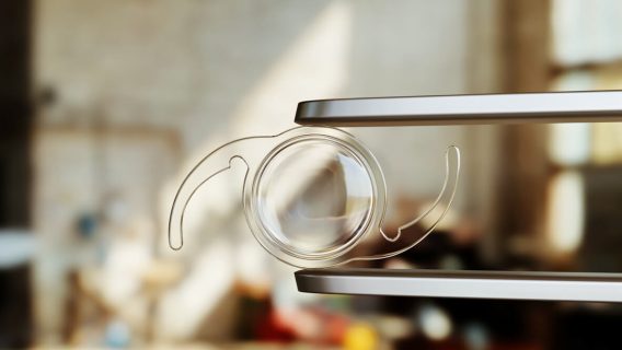 A intraocular lens used for cataract surgery.