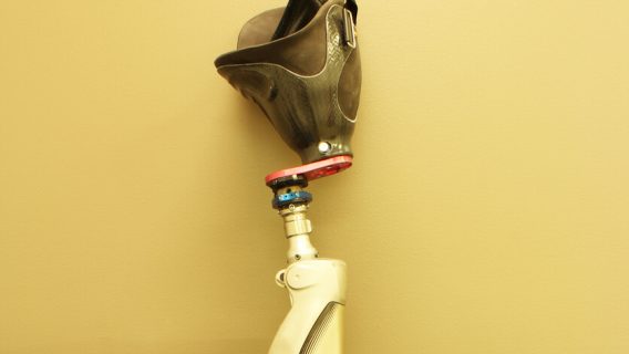 Prosthetic leg for amputee