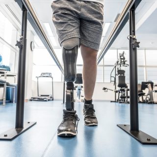 Man standing with amputated leg