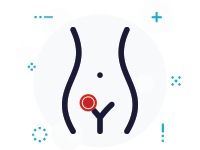 inguinal hernia