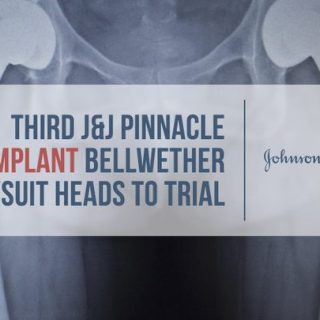 xray of double hip implants