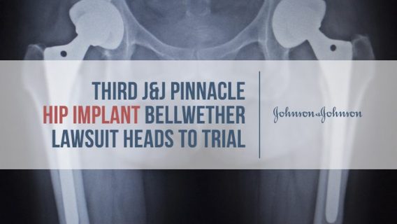 xray of double hip implants