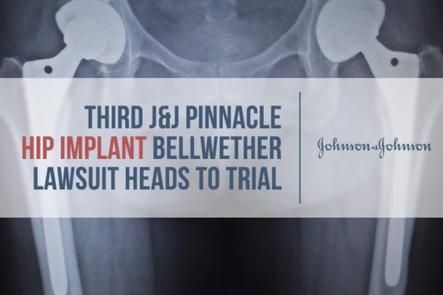xray of double hip implants