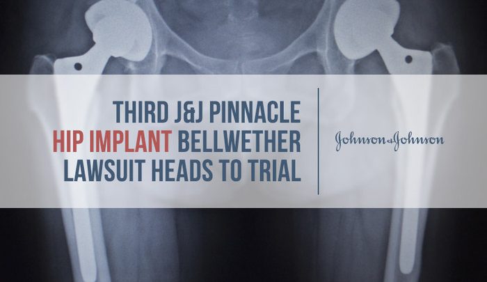 xray of double hip implants