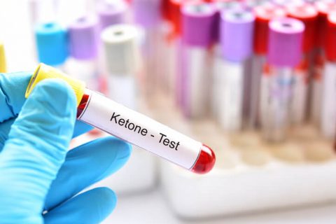 Blood sample tube for ketone test