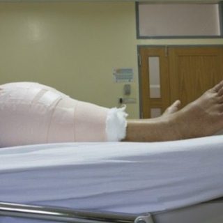knee in bandages