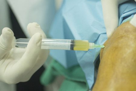 Nurse draining fluid from knee