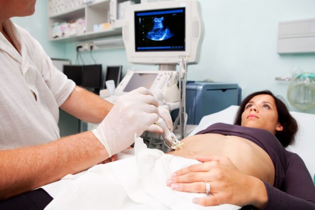 Doctor performing a liver biopsy