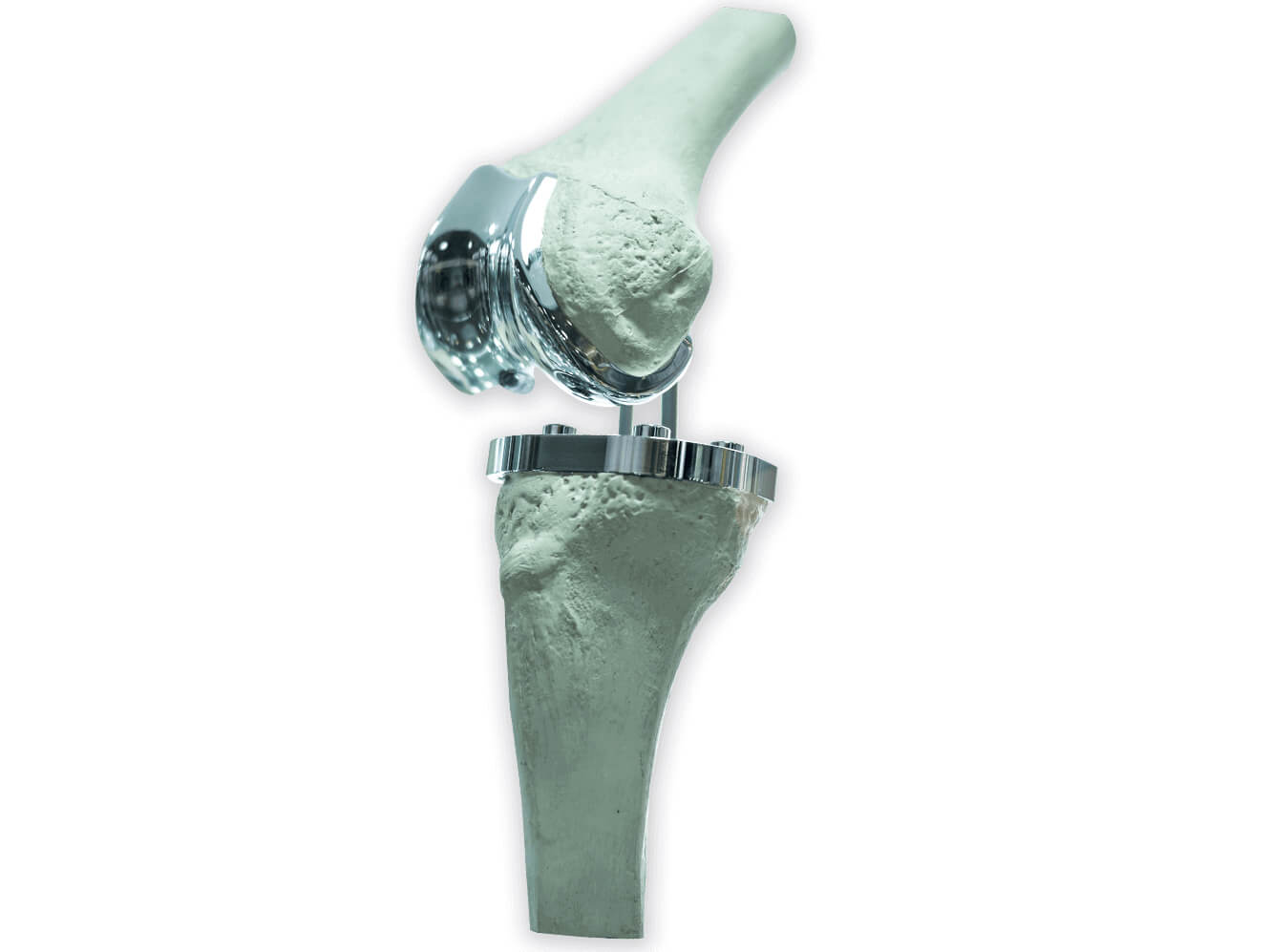 knee joint replacement devices