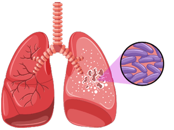 Mycobacteria Illustration