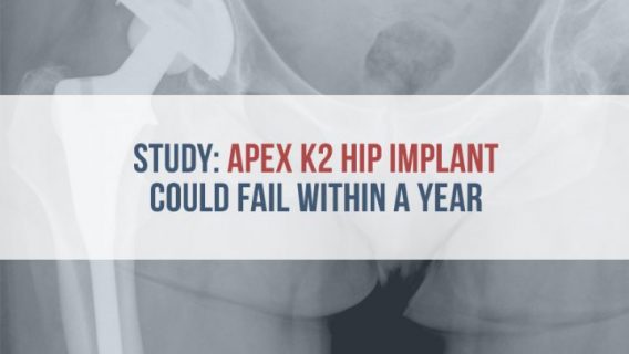 X-ray of hip implant