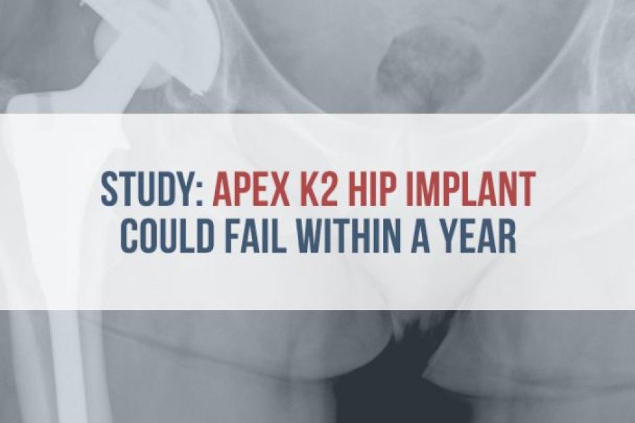 X-ray of hip implant