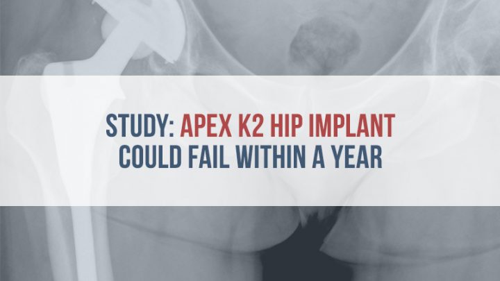 X-ray of hip implant