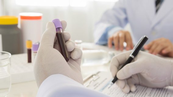 gloved hand holding a blood sample and documenting it