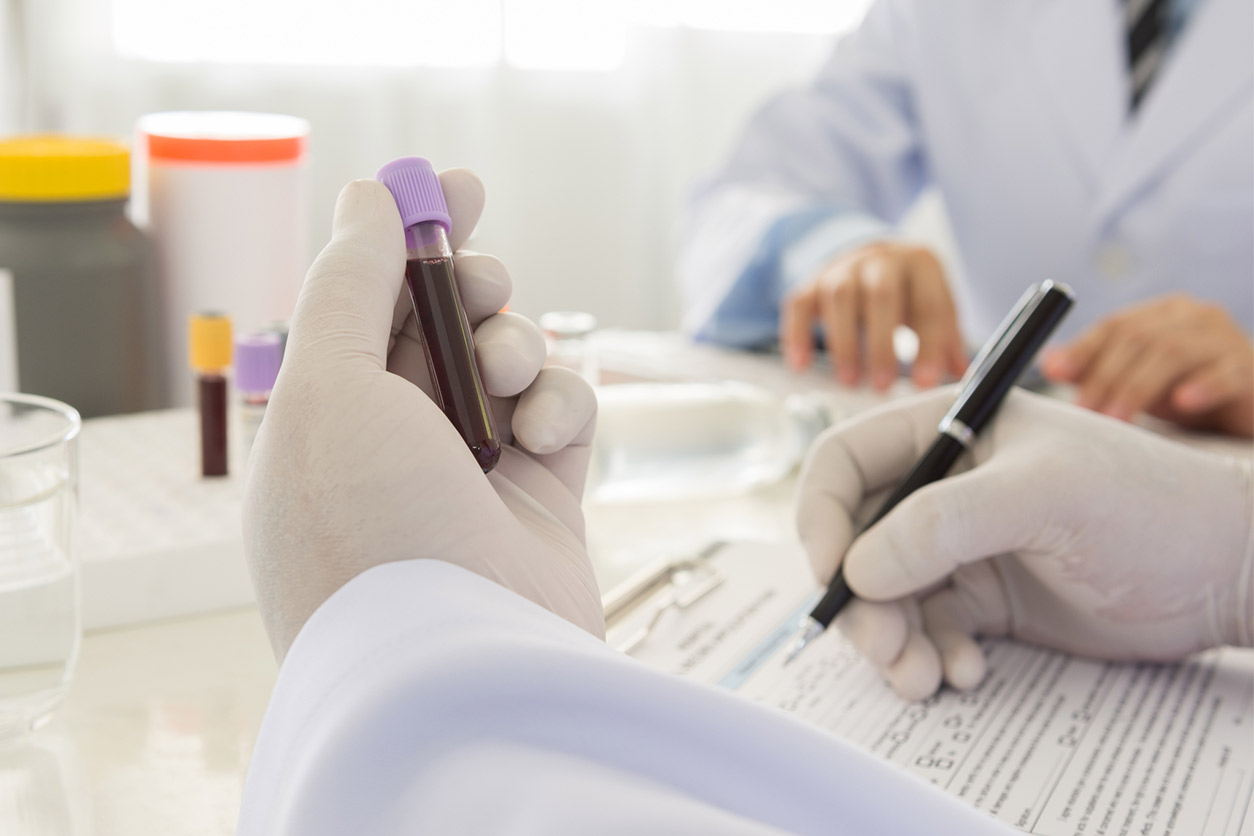 gloved hand holding a blood sample and documenting it