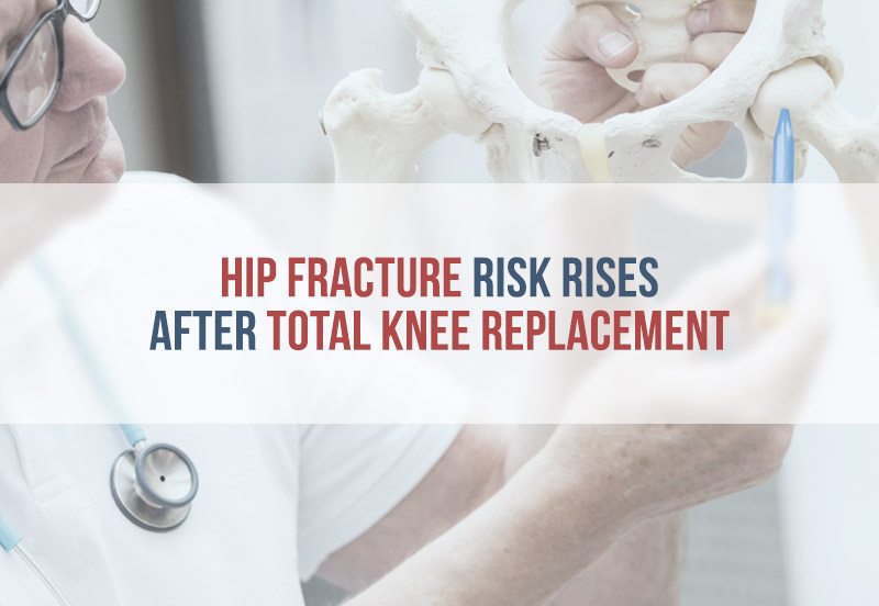 doctor examines a 3d model of a hip bone
