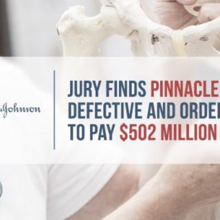 doctor examines hip bone 3d model