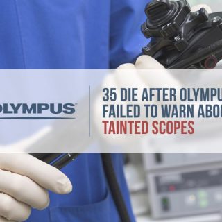 gloved surgeon holding a medical scope