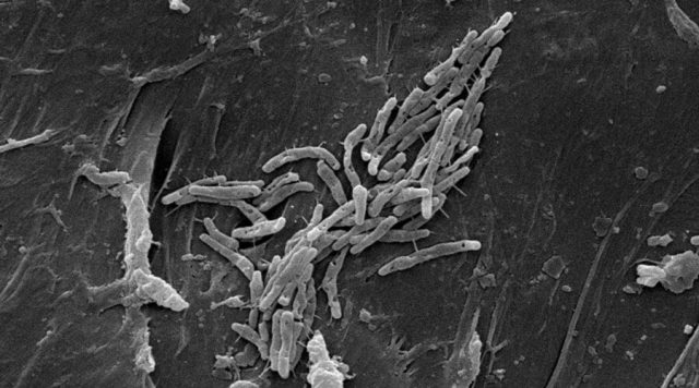 Closeup image of M. fortuitum Mycobacterium