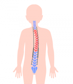 Image depicting a spine straightener implanted to fix a crooked spine