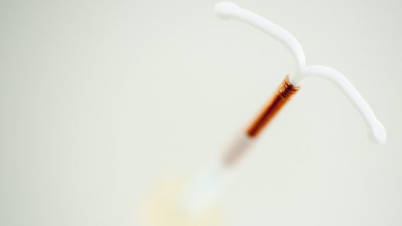 ParaGard Copper IUD