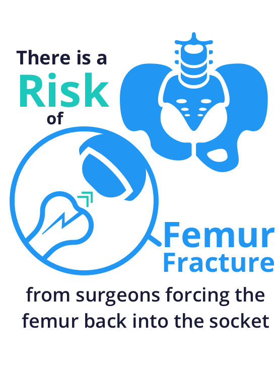 Is leg swelling a possible complication following hip replacement?