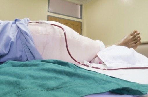 patient's leg after knee surgery