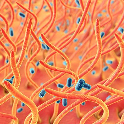 Microscopic view of pertussis