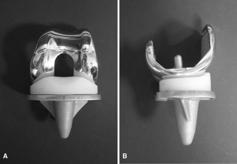 DePuy Attune Rotating Platform Design