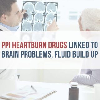 doctor explaining brain scan to an elderly male patient