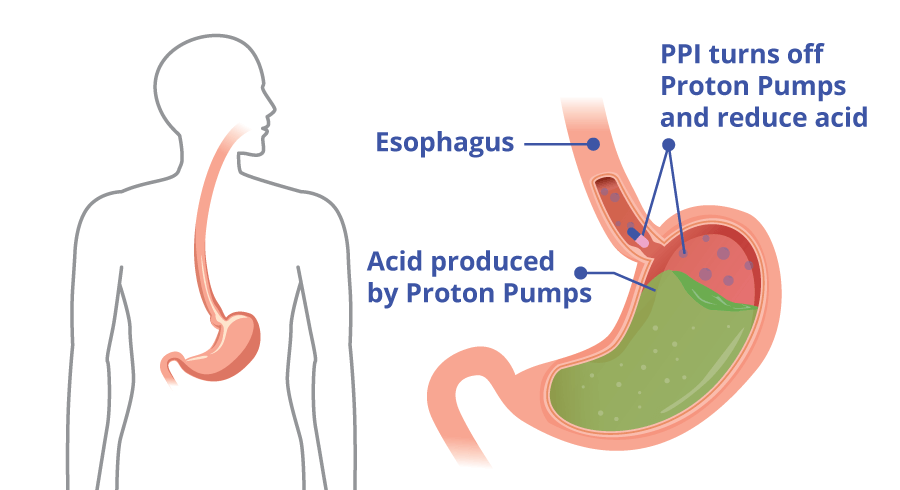 Image result for proton pump inhibitors