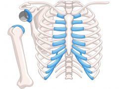 Reverse Shoulder Replacement Implant