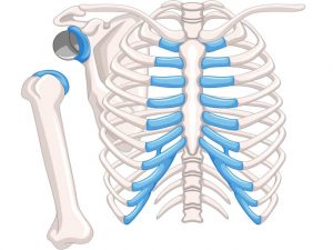 Reverse Shoulder Replacement
