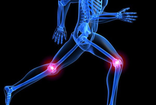 Knee replacement surgery rises among younger adults X-ray of skeleton running with knee pain