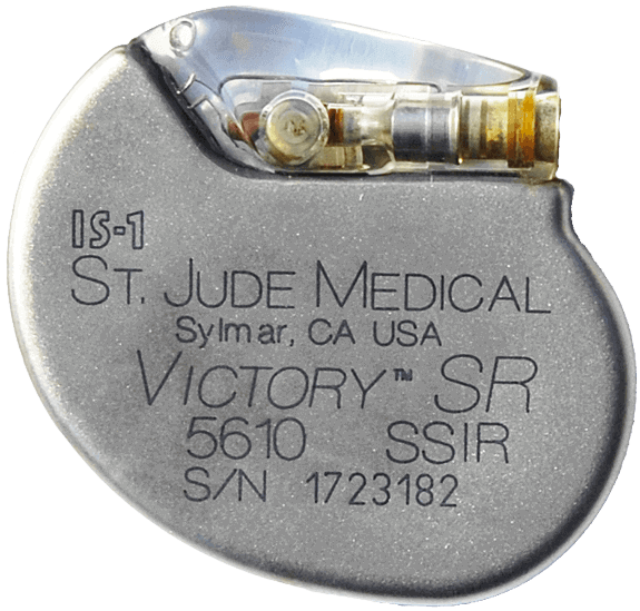 St. Jude defibrillator implant